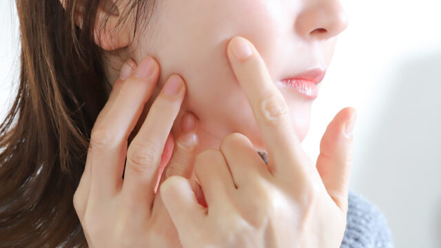 横手市の美容鍼 初回5,000円 約30分ライト体験