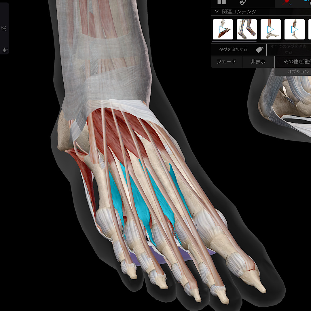足の甲の痛みでお悩みの方へ今回は背側骨間筋が原因です｜横手市の鍼灸院