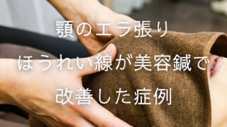 顎のエラ張り・ほうれい線が美容鍼で改善した症例 ｜横手市の鍼灸院 杉沢はりきゅう院