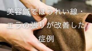 40代女性・ほうれい線とエラの張りが気になり美容鍼を初体験。2回の施術でお顔がシュッと小さくなったと喜ばれた症例です。横手市の杉沢はりきゅう院でご紹介します。