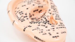 耳つぼに鍼。どこに貼るかよりなぜ、そこに貼るのか。