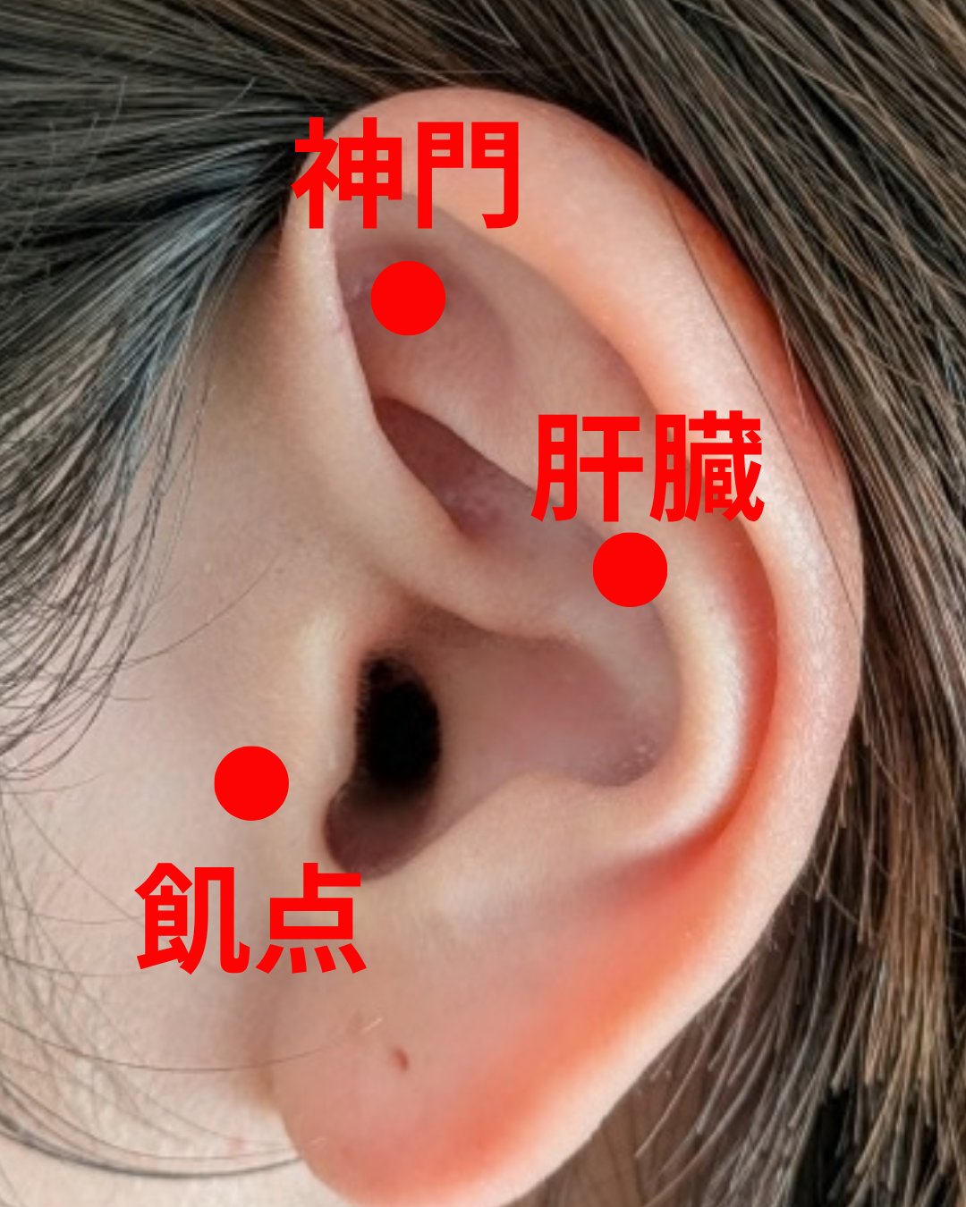 気太り（胃熱、気滞、膨満感、実脈、弦脈）
