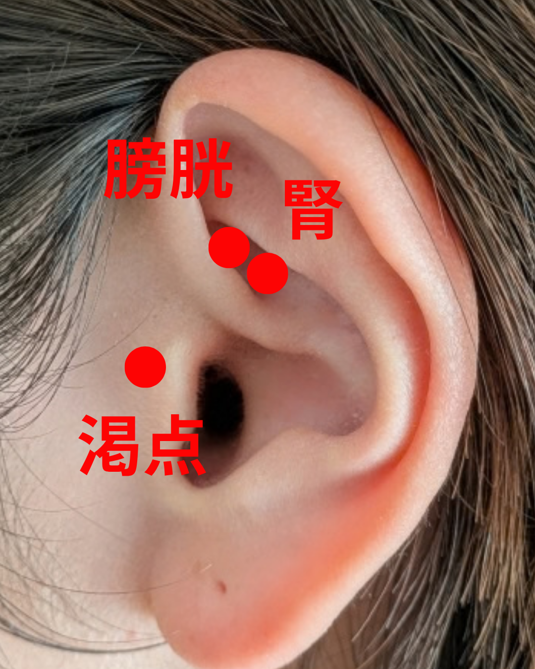 水太り（むくみ、気虚、陽虚、遅脈）の場合